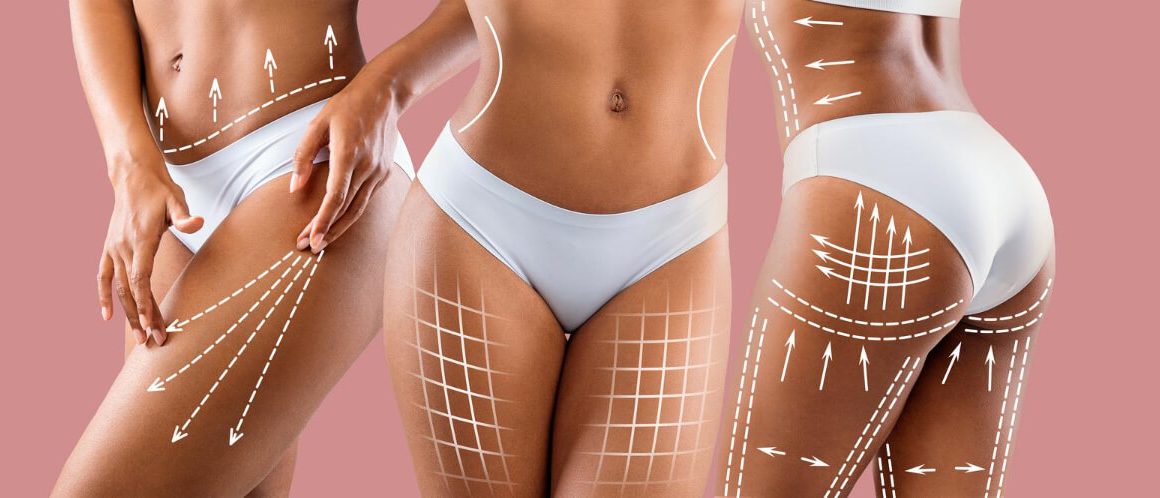 “body contouring concept” Exploring Body Contouring: What It Is and Why It Matters