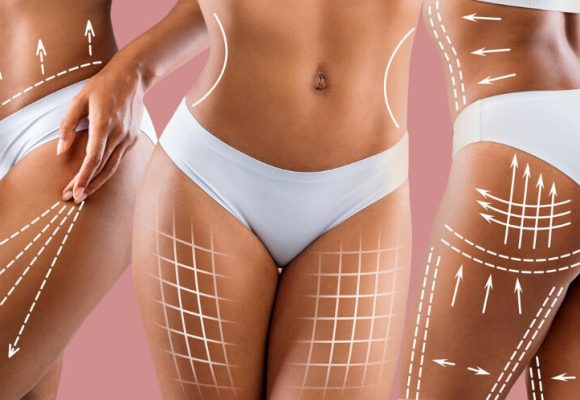 “body contouring concept” Exploring Body Contouring: What It Is and Why It Matters