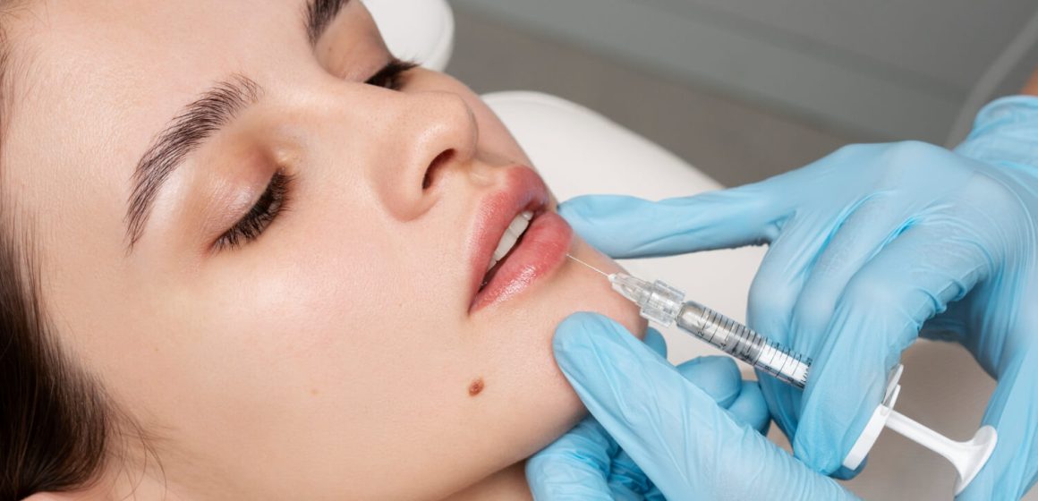Dermal fillers in Surf City (2) Dermal fillers in Surf City